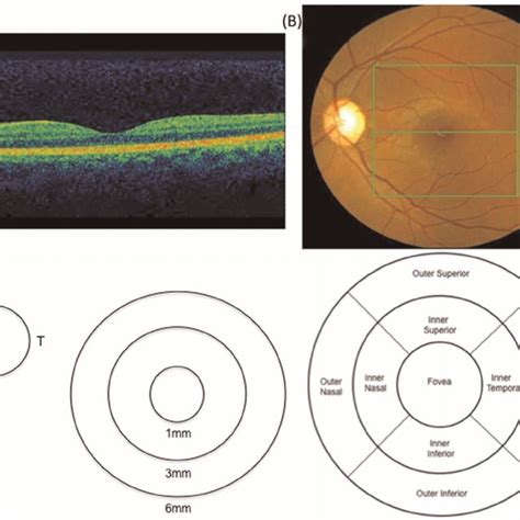 oct macular thickness measurements|macular thickness treatment.